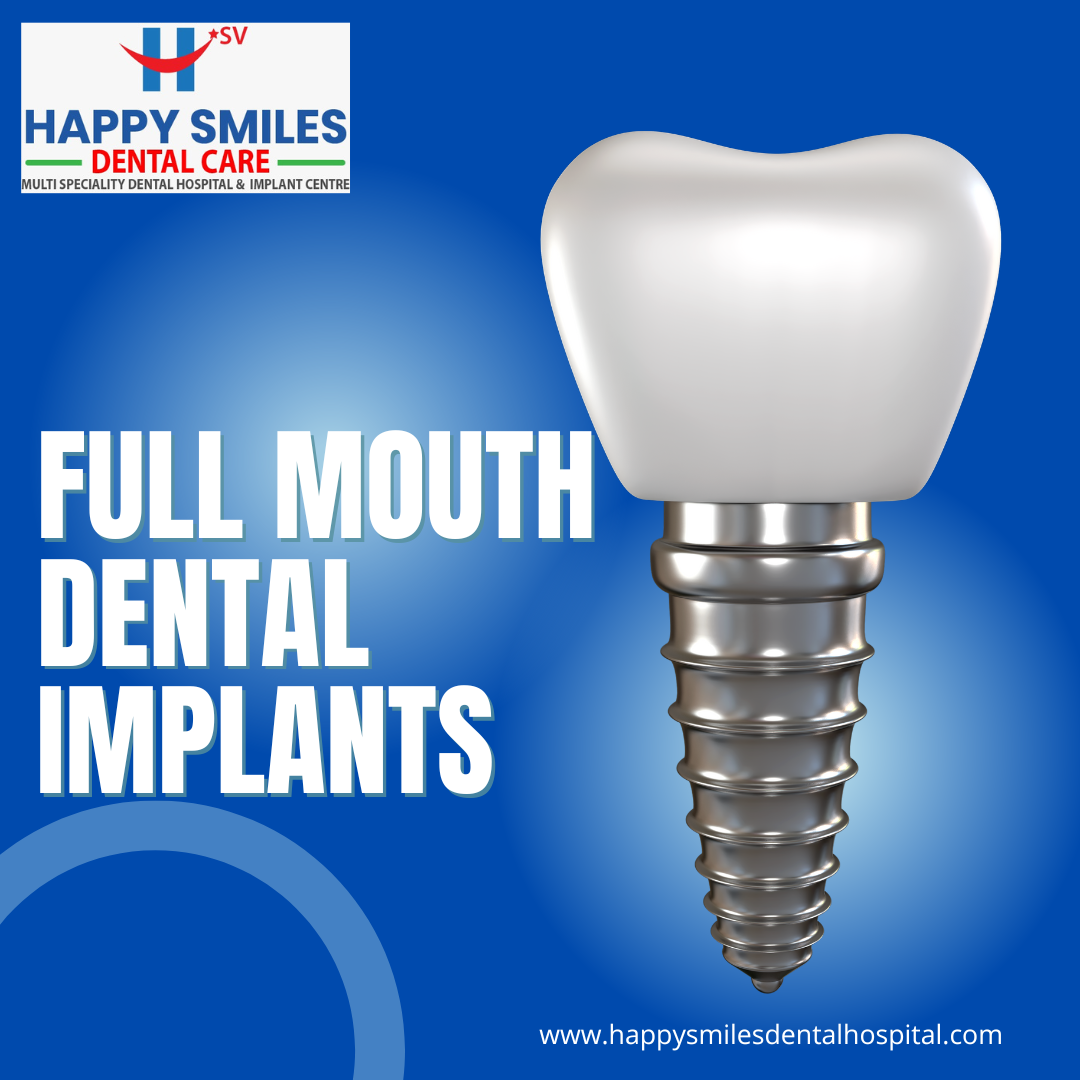 full mouth dental implants treatment