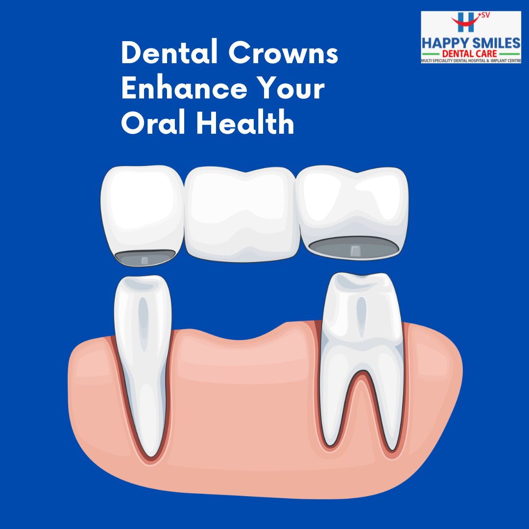 Dental Crowns Enhance Your Oral Health